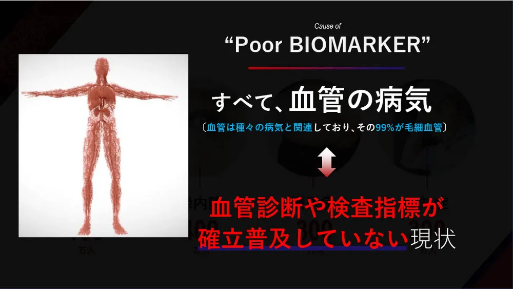 大学発ベンチャーの先端技術～毛細血管測定による健康・未病指標の確立（あっと株式会社）