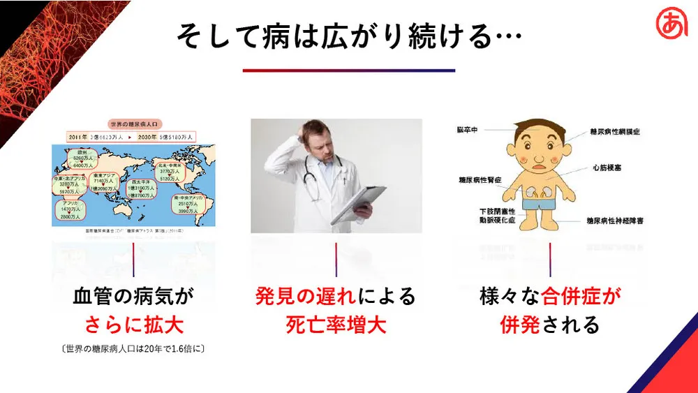 大学発ベンチャーの先端技術～毛細血管測定による健康・未病指標の確立（あっと株式会社）