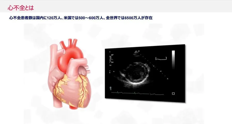 大学発ベンチャーの先端技術～心筋再生医療イノベーション（Heartseed株式会社）