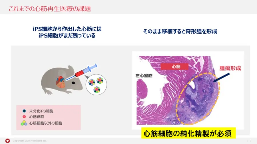 大学発ベンチャーの先端技術～心筋再生医療イノベーション（Heartseed株式会社）