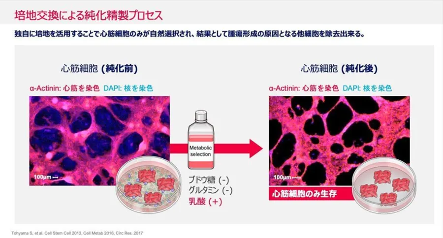 大学発ベンチャーの先端技術～心筋再生医療イノベーション（Heartseed株式会社）