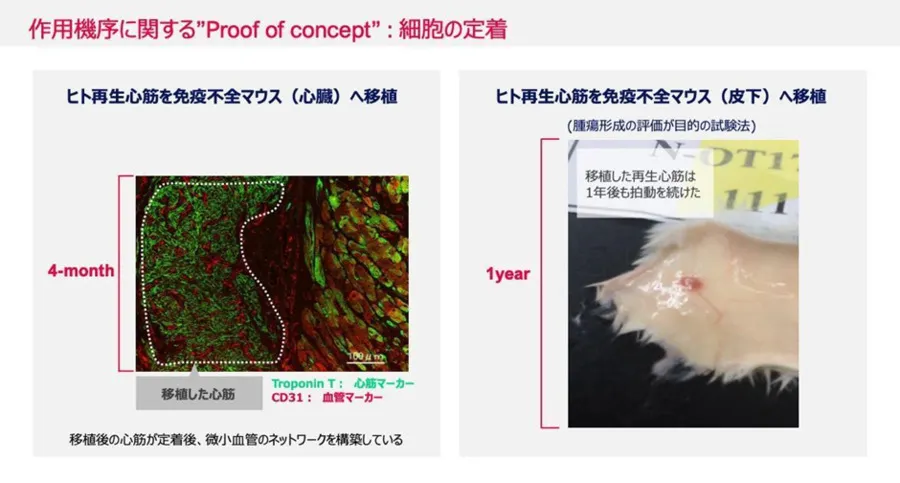 大学発ベンチャーの先端技術～心筋再生医療イノベーション（Heartseed株式会社）